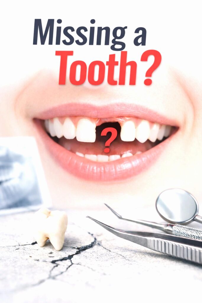Don’t Ignore a Missing Tooth